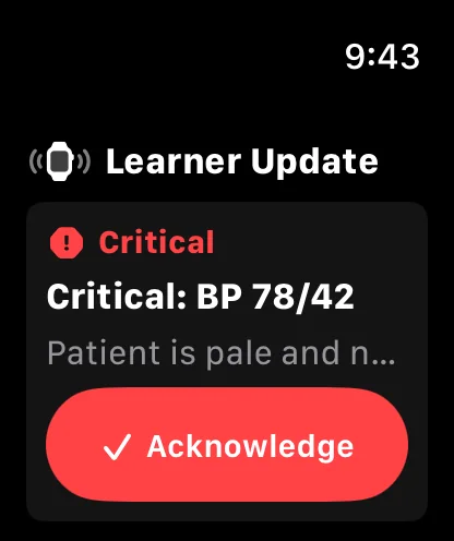 Critical patient update displayed in Bedside Coach on Apple Watch